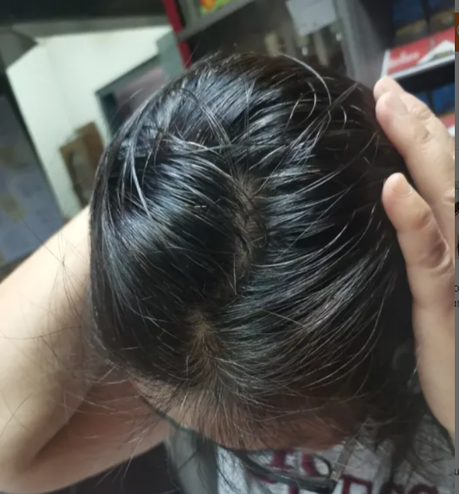 Rezultat BioColor – Bianca