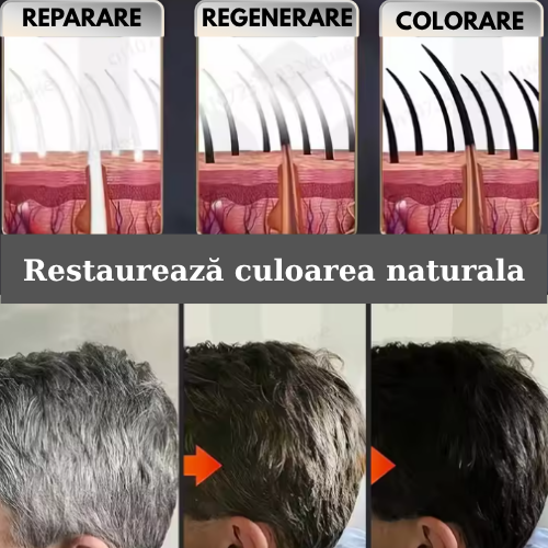 Before and After BioColor