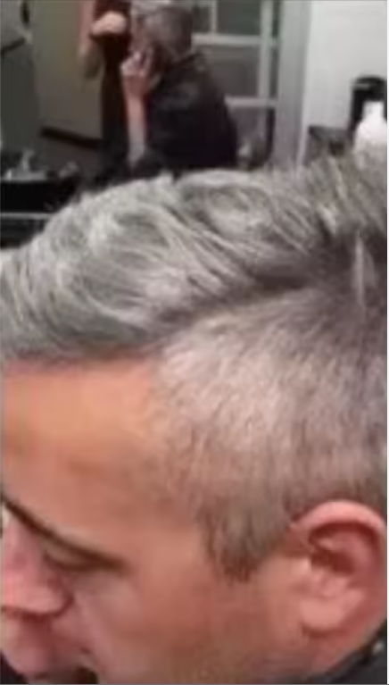 Înainte – păr grizonat, client 1