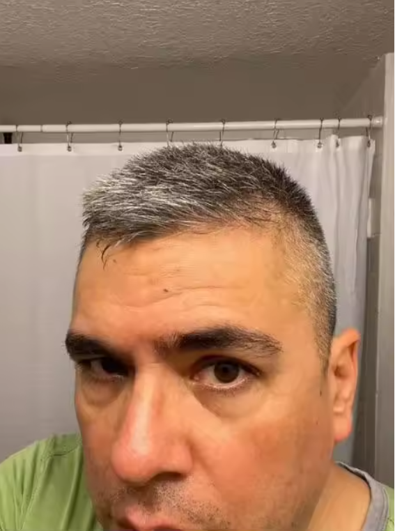 Înainte – păr grizonat, client 2