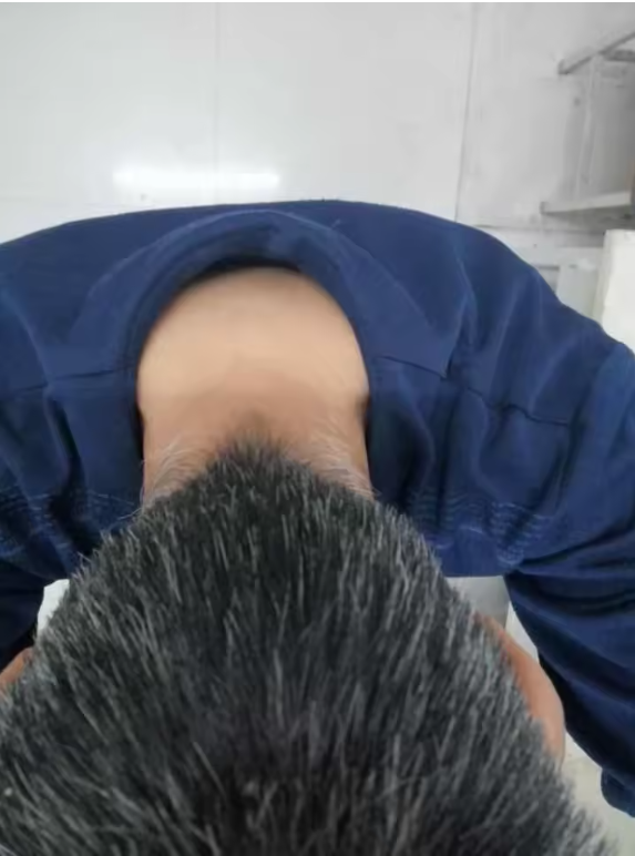 Înainte – rădăcini grizonate, client 3