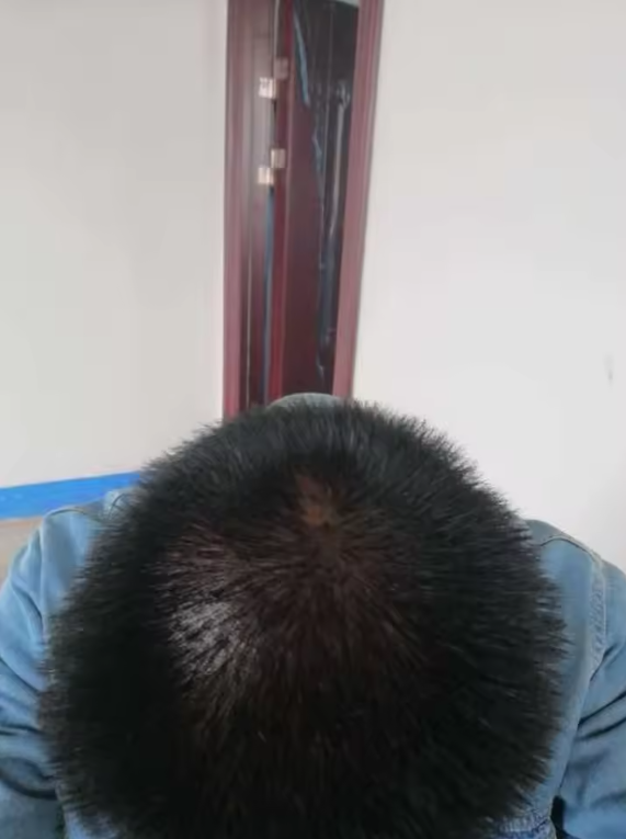 După – acoperire uniformă, client 3