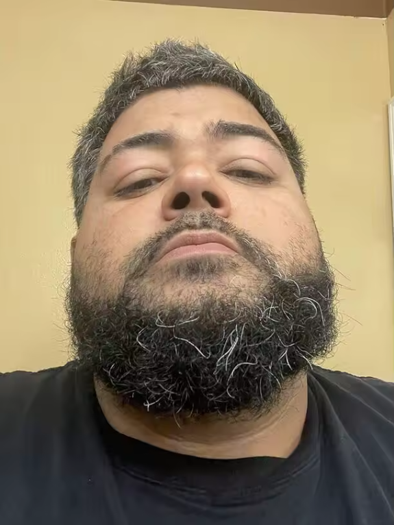 Înainte – barbă cu fire albe, client 4