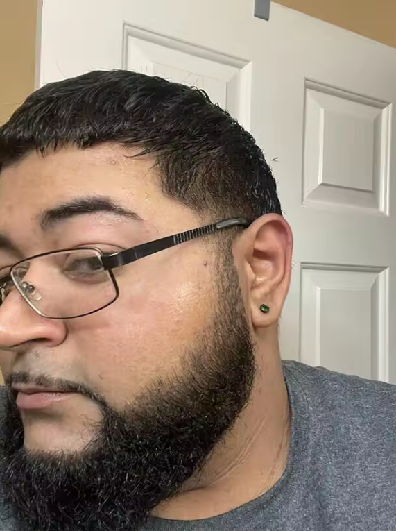 După – barbă uniformă, client 4